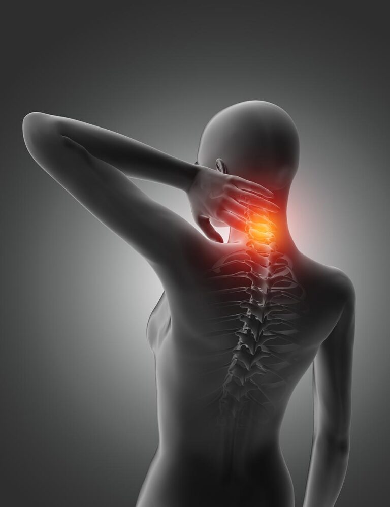 Read more about the article Cervical Spondylosis: Causes, Symptoms, and Treatment Options in Ahmedabad, India