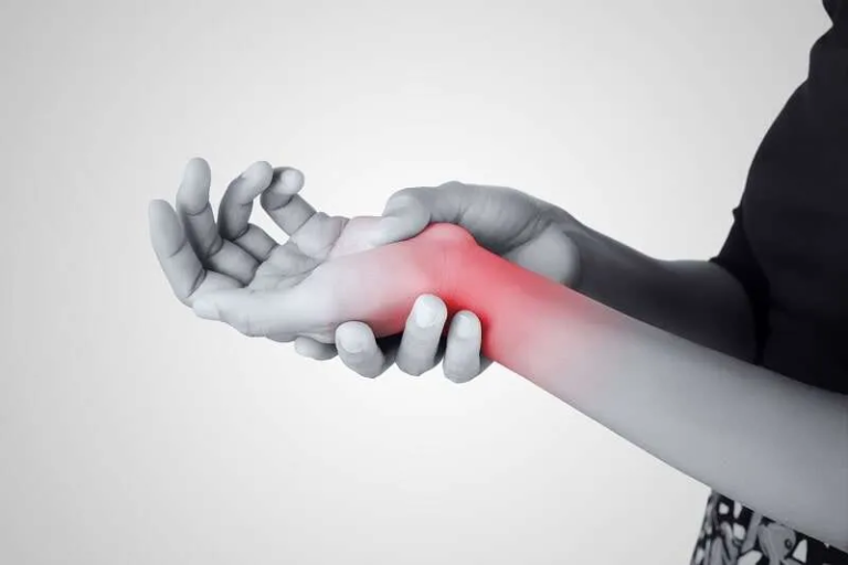 Read more about the article DE QUERVAIN’S TENOSYNOVITIS